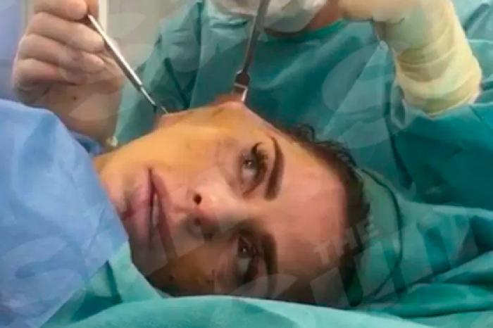 Известная телеведущая записала себя на видео во время пластической операции