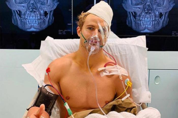 Дебют бывшего бойца UFC в Азии стоил ему многочасовой операции на лице