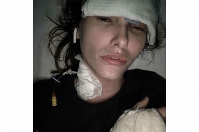 Свидетель по делу Кокорина и Мамаева показала первое фото после падения из окна
