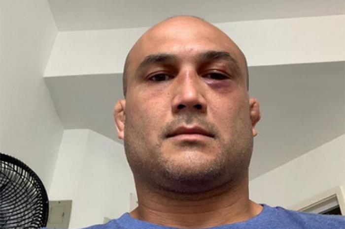Бывший чемпион UFC оправдался за нокаут от полураздетого мужчины на улице