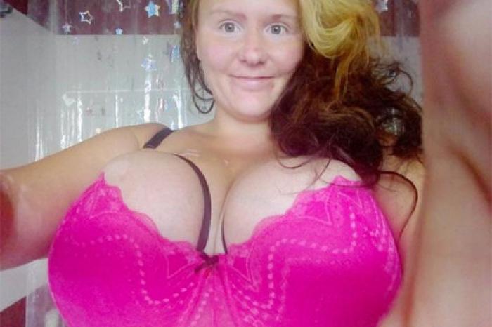 Женщина рассказала о страданиях из-за огромной груди