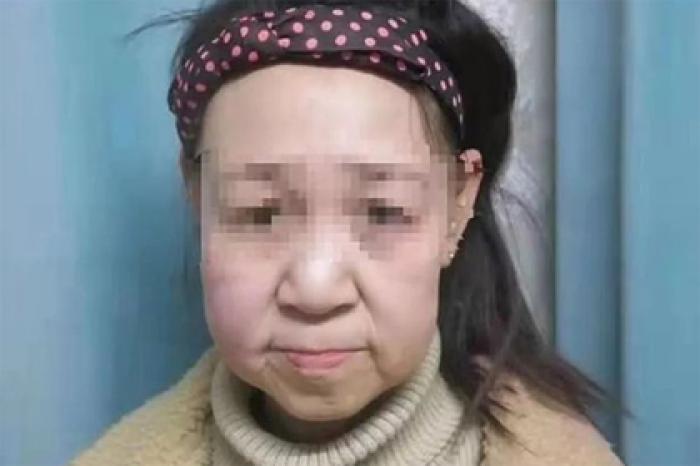 Девочку с лицом старушки прозвали уродливой и вынудили бросить школу