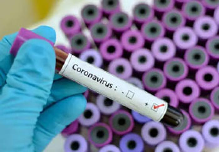 MINISTERUL SĂNĂTĂŢII A CONFIRMAT AL PATRULEA CAZ DE INFECTARE DE CORONAVIRUS ÎN MOLDOVA, IAR ALTE 30 DE CAZURI AŞTEAPTĂ REZULTATELE
