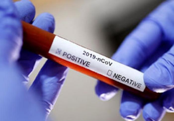 ​ÎN MOLDOVA A FOST CONFIRMAT PRIMUL CAZ DE CORONAVIRUS