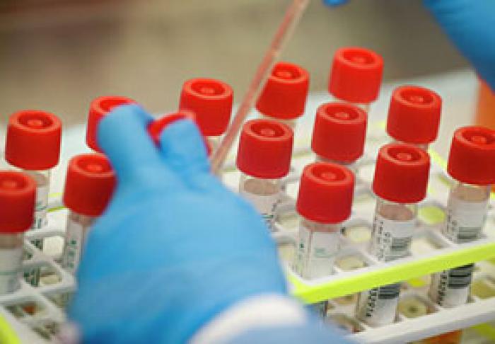 ÎN TRANSNISTRIA AU FOST CONSTATATE PRIMELE DOUĂ CAZURI DE INFECTARE CU CORONAVIRUS