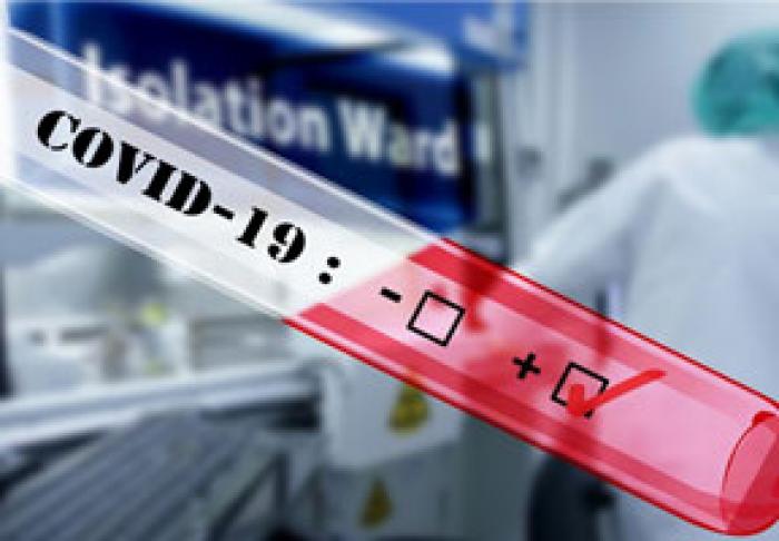 NUMĂRUL PERSOANELOR INFECTATE CU COVID-19 ÎN MOLDOVA A AJUNS LA 125