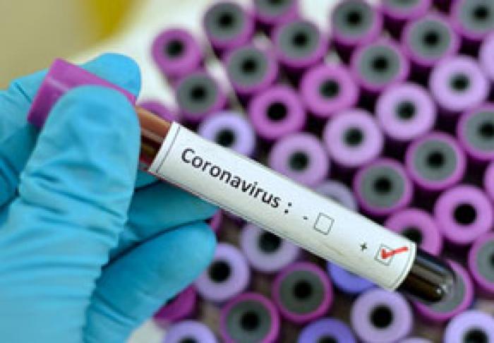 NUMĂRUL PERSOANELOR INFECTATE DE COVID-19 ÎN MOLDOVA A CRESCUT ÎN ULTIMELE 24 DE ORE CU 20%
