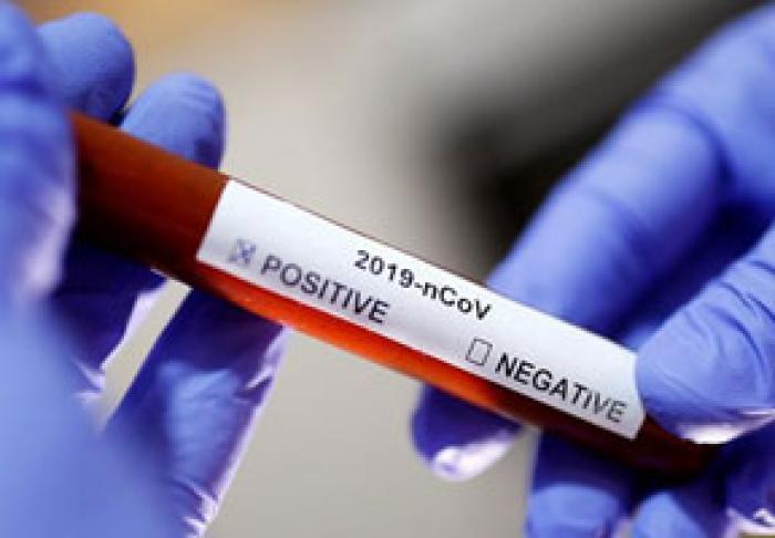 MARŢI AU FOST ÎNREGISTRARE 135 DE CAZURI NOI DE INFECTARE CU CORONAVIRUS, IAR NUMĂRUL TOTAL A AJUNS LA 1847 DE CAZURI