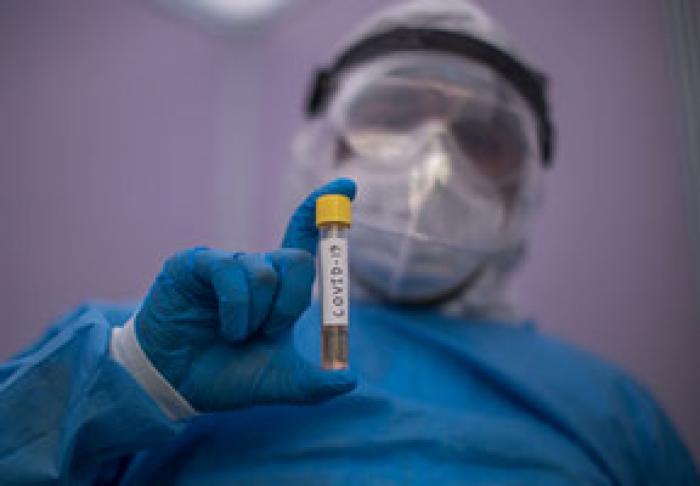 MINISTERUL SĂNĂTĂŢII: 98% DIN PERSOANELE DECEDATE DE CORONAVIRUS ÎN MOLDOVA SUFEREAU ŞI DE ALTE BOLI