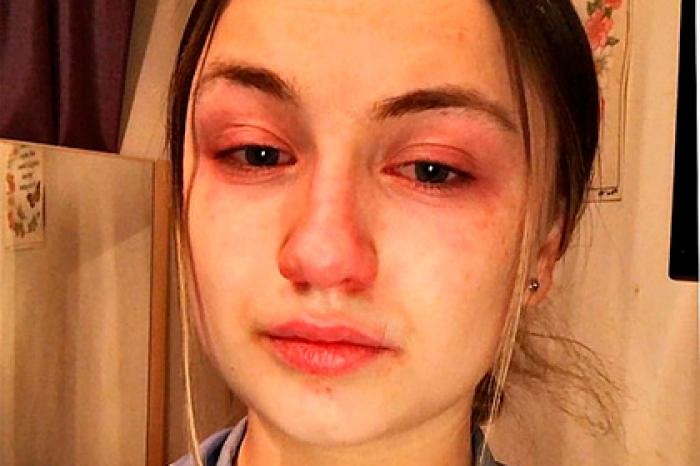 Работающая по 13 часов в день медсестра рассказала о муках зараженных пациентов