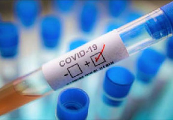 MOLDOVA: 4363 PERSOANE INFECTATE, 1544 PERSOANE VINDECATE, 136 PERSOANE DECEDATE