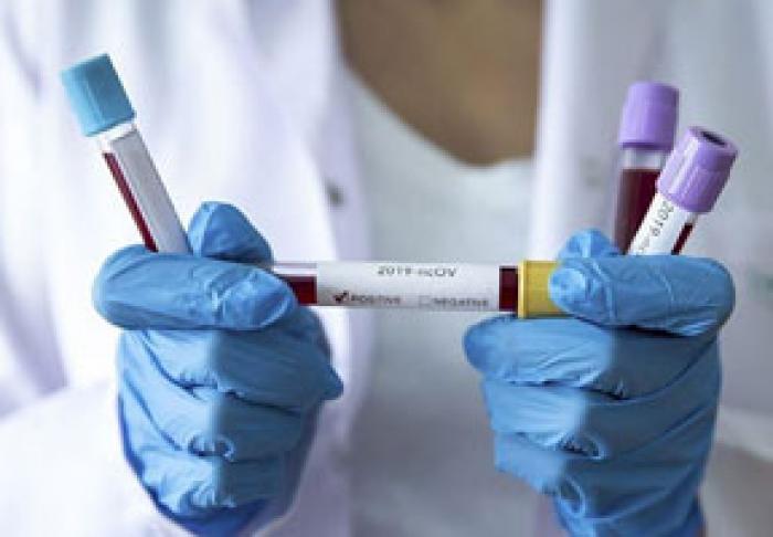 ÎN ACEASTĂ NOAPTE, ÎNCĂ PATRU PERSOANE AU DECEDAT DE CORONAVIRUS