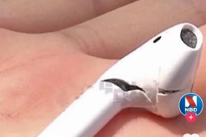 AirPods взорвались в ухе у человека