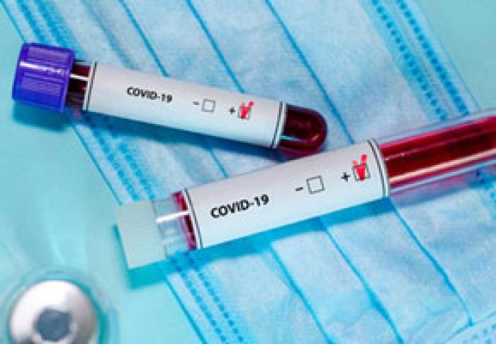 LUNI, ÎN MOLDOVA AU FOST ÎNREGISTRATE 107 CAZURI NOI DE CORONAVIRUS, IAR TREI PERSOANE AU DECEDAT