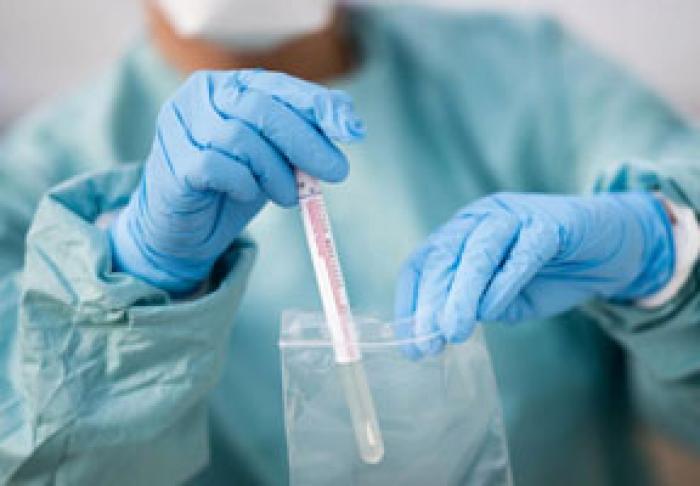 ​LUNI, ÎN MOLDOVA AU FOST ÎNREGISTRATE 139 DE CAZURI NOI DE CORONAVIRUS