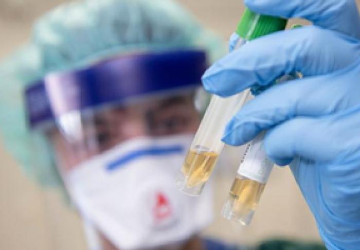 ÎN MOLDOVA AU FOST ÎNREGISTRATE 16 250 CAZURI DE INFECTARE CU CORONAVIRUS