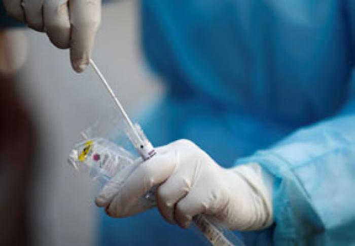​ÎN MOLDOVA AU FOST ÎNREGISTRATE 163 DE CAZURI NOI DE CORONAVIRUS, IAR ŞAPTE PERSOANE AU DECEDAT