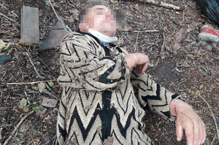 В российском регионе объяснились за брошенного у гаражей пациента в памперсе