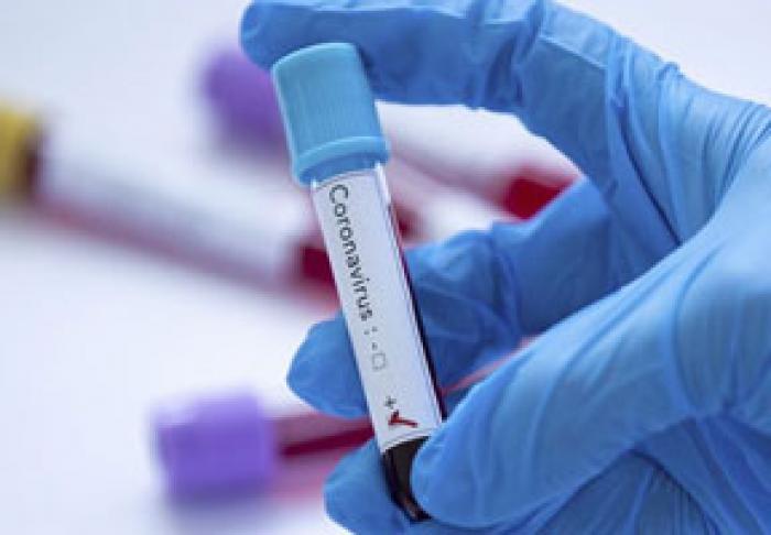 ÎN MOLDOVA AU FOST ÎNREGISTRATE PESTE 21 MII CAZURI DE INFECTARE CU CORONAVIRUS, IAR APROAPE 700 DE PERSOANE AU DECEDAT