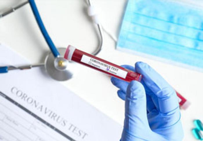 ÎN MOLDOVA, VÂRSTA MEDIE A CELOR INFECTAŢI CU COVID-19 ESTE DE 47 DE ANI