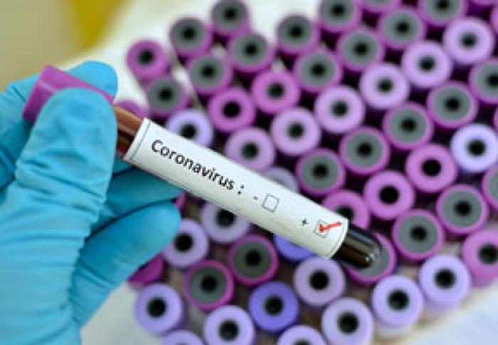 ​ SITUAŢIA EPIDEMIOLOGICĂ DIN TRANSNISTRIA RĂMÂNE CONSTANT NEFAVORABILĂ