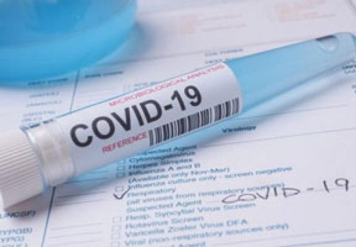 12 MII CAZURI DE INFECȚIE CU CORONAVIRUS ÎN AUGUST, O TREIME DIN NUMĂRUL TOTAL DE INFECȚII