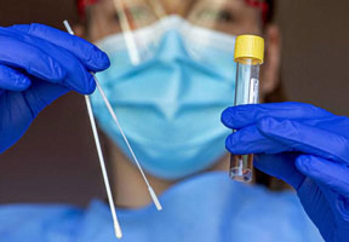 MINISTRUL SĂNĂTĂŢII: ÎN CURÂND, ÎN MOLDOVA SE VOR EFECTUA NU MAI PUŢIN DE 5000 DE TESTE PE ZI LA COVID-19