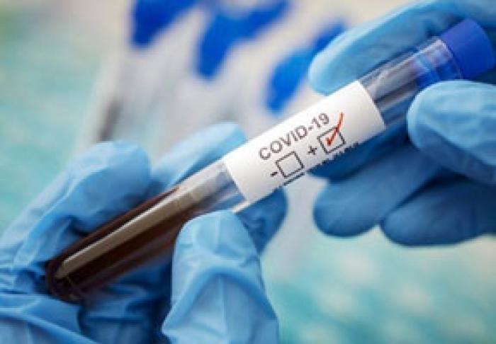 SĂPTĂMÂNA TRECUTĂ S-AU ÎNREGISTRAT CIFRE RECORD DE INFECTARE ŞI DE DECESE CAUZATE DE COVID-19