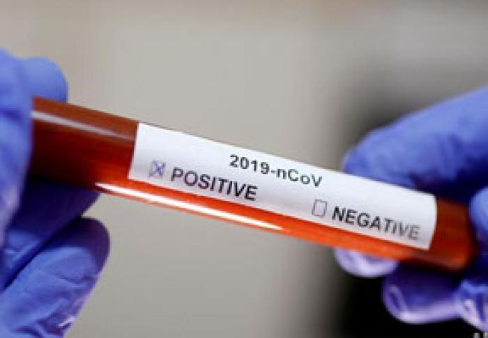 SĂPTĂMÂNA TRECUTĂ, ÎN MOLDOVA A FOST STABILIT UN NOU ANTI-RECORD PRIVIND NUMĂRUL DE INFECTĂRI CU CORONAVIRUS