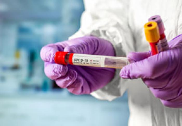 SĂPTĂMÂNA TRECUTĂ ÎN MOLDOVA A FOST ÎNREGISTRAT CEL MAI MIC NUMĂR DE CAZURI DE CORONAVIRUS DE LA ÎNCEPUTUL LUNII NOIEMBRIEI - MINISTERUL SĂNĂTĂȚII