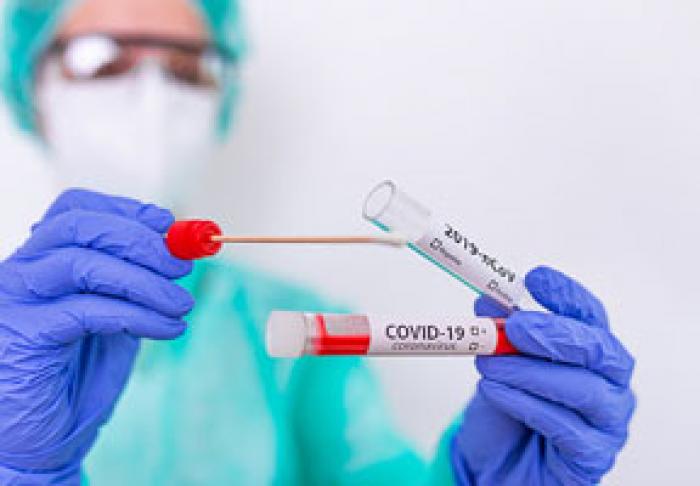 NUMĂRUL DE NOI CAZURI DE INFECŢIE PRIN COVID-19 A CONTINUAT SĂ SCADĂ SĂPTĂMÂNA TRECUTĂ