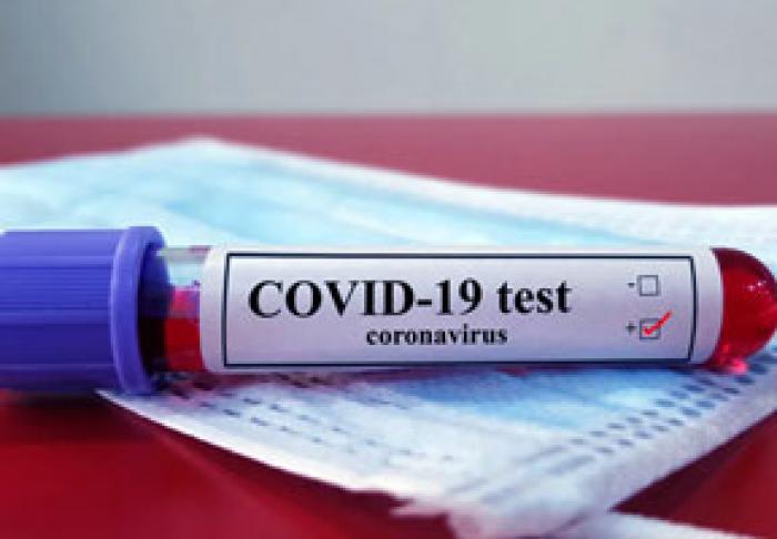 ​REDUCERE SEMNIFICATIVĂ A CAZURILOR COVID-19 ÎNREGISTRATE ÎN TIMPUL REVELIONULUI ȘI DE CRĂCIUN