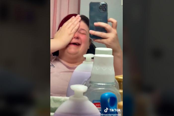 Девушка сделала эпиляцию в домашних условиях и осталась со склеенными бедрами