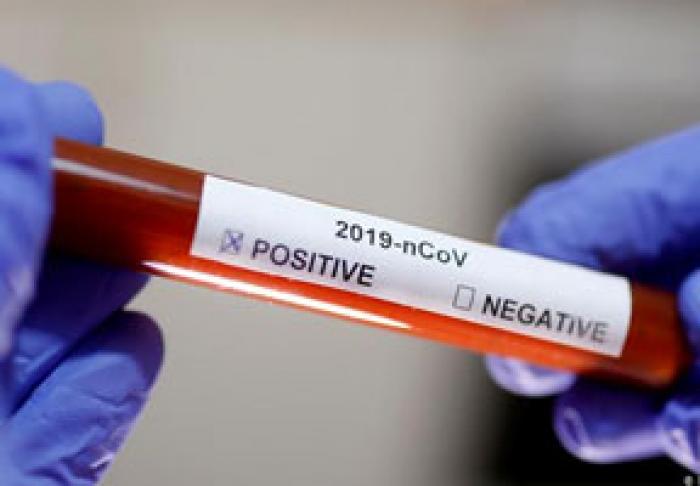 APROAPE 10 MII DE CAZURI DE INFECȚIE PRIN CORONAVIRUS AU FOST ÎNREGISTRATE SĂPTĂMÂNA TRECUTĂ: MINISTERUL SĂNĂTĂȚII