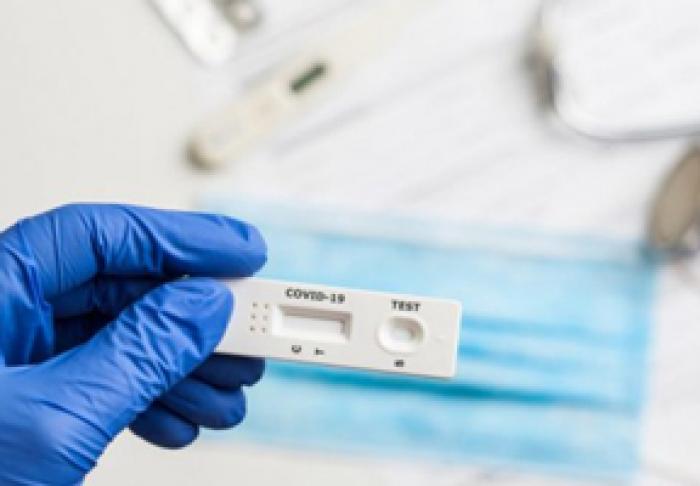 MINISTERUL SĂNĂTĂŢII A ACHIZIŢIONAT ŞI A DISTRIBUIT INSTITUŢIILOR MEDICALE PUBLICE TESTE RAPIDE PENTRU DEPISTAREA ANTIGENULUI SARS-COV-2