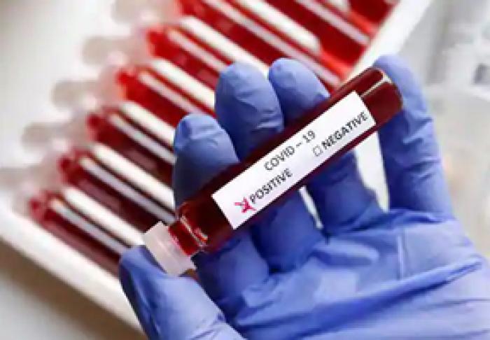 UN NUMĂR RECORD DE CAZURI ȘI DECESE CAUZATE DE COVID-19 A FOST ÎNREGISTRAT ÎN MOLDOVA SĂPTĂMÂNA TRECUTĂ: MINISTERUL SĂNĂTĂŢII