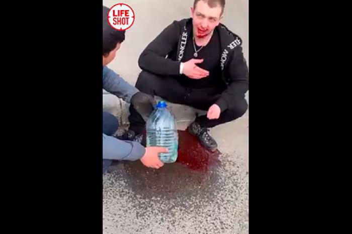 Рэпер Yung Trappa попал в ДТП и лишился зубов