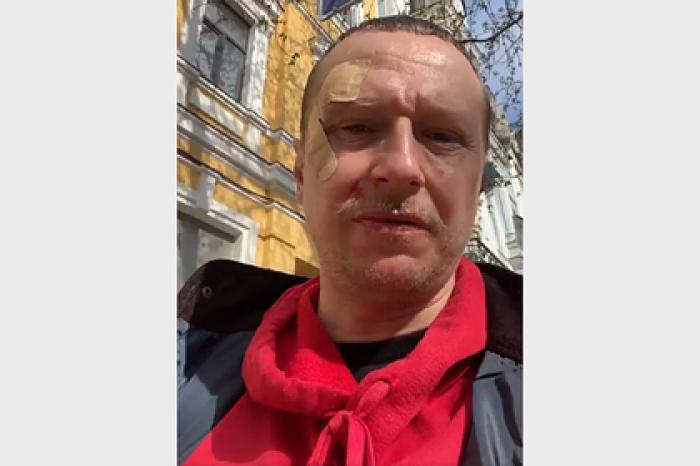 В Киеве побили известного ведущего