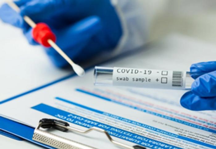 NUMĂRUL DE CAZURI NOI DE INFECŢIE COVID-19 ÎN MOLDOVA ESTE ÎN SCĂDERE: MINISTERUL SĂNĂTĂŢII
