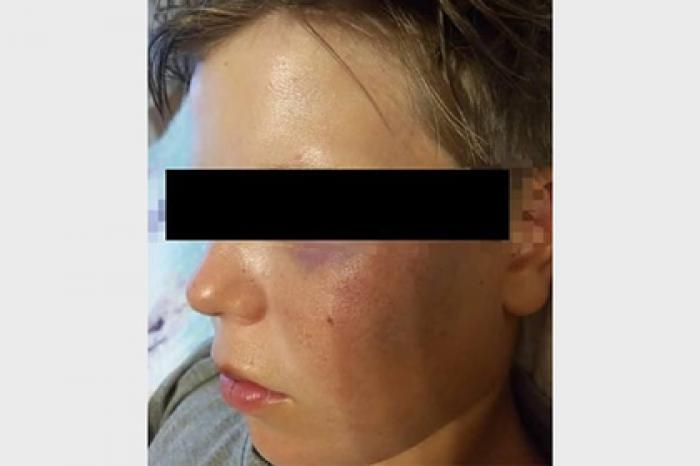 В Киргизии русского ребенка избивали из-за его национальности