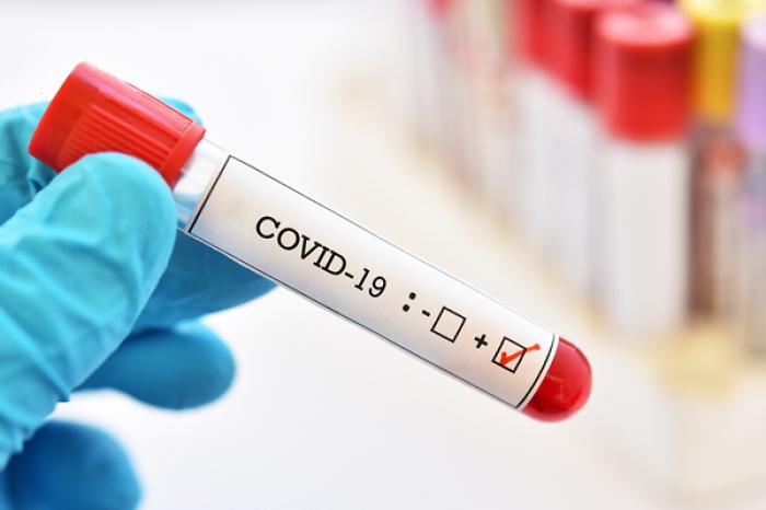 ​ЧИСЛО СЛУЧАЕВ ЗАБОЛЕВАНИЯ COVID-19 ВОЗРОСЛО В МОЛДОВЕ НА ПРОШЛОЙ НЕДЕЛЕ НА 60%