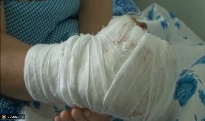 На бельцком хлебокомбинате сотруднице отрезало пальцы на руке