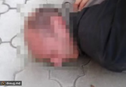 Сестра убитой в Мэгдэчешть попала под подозрение
