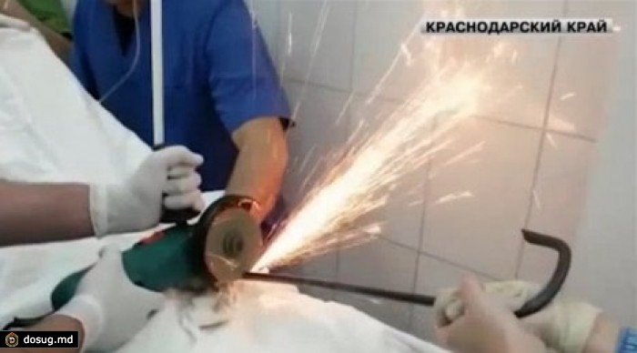 Школьник из Краснодара выжил, упав с высоты на гарпун