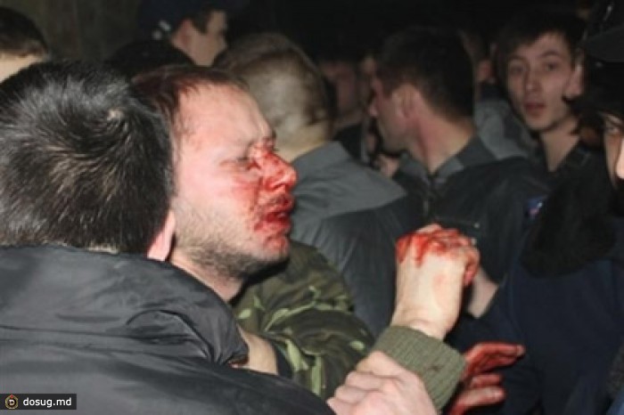 Украинские радикалы устроили драку на концерте во Львове