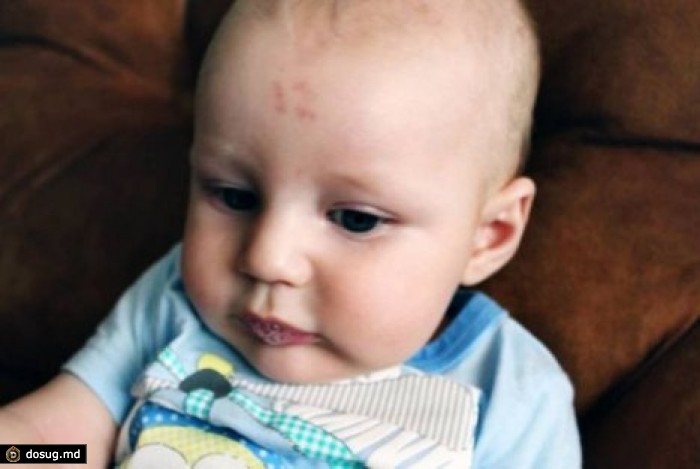 В ЮАР родился малыш с цифрой 12 на голове