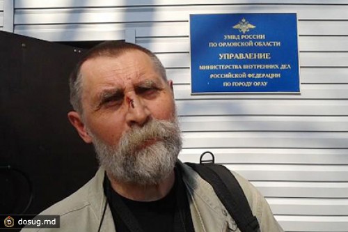 В Орле правозащитнику сломали нос