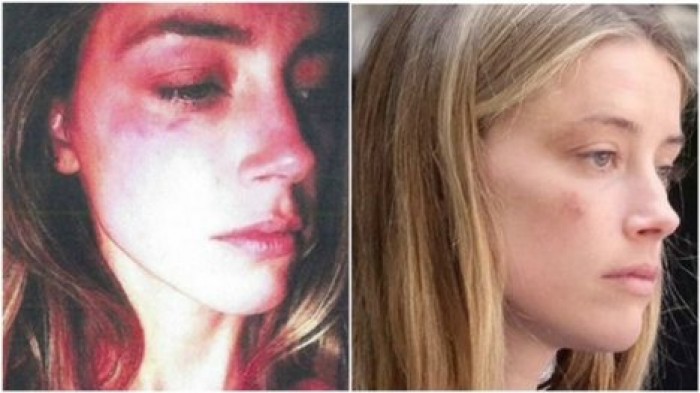 Эмбер Херд заявила на Джонни Деппа в полицию