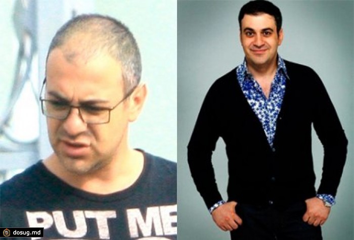 Гарик Мартиросян подает в суд на интернет-мошенников из-за рекламы средства от облысения с его участием