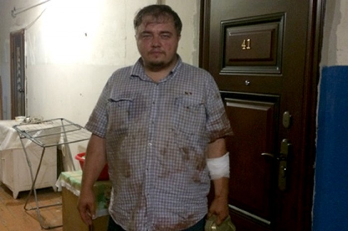 Подмосковный двойник Ди Каприо пожаловался на укусы наркомана